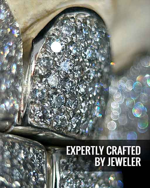 Custom grillz showcase 4 - crafted by expert jewelers
