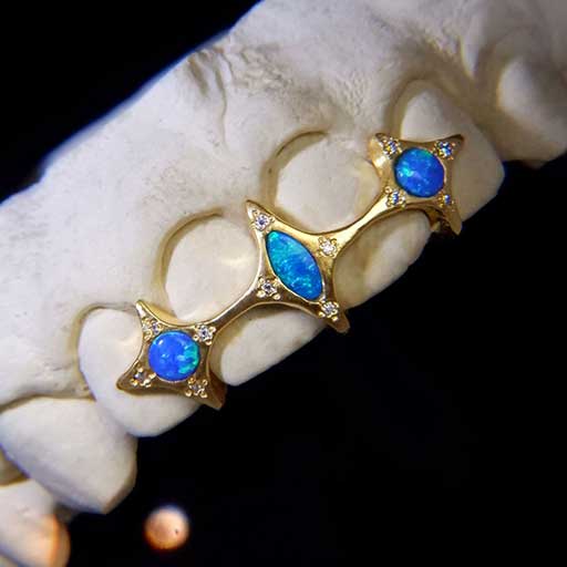 DATUWRKS custom grillz gallery showcase 20