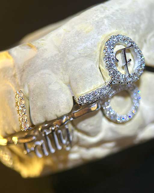 DATUWRKS custom grillz gallery showcase 8