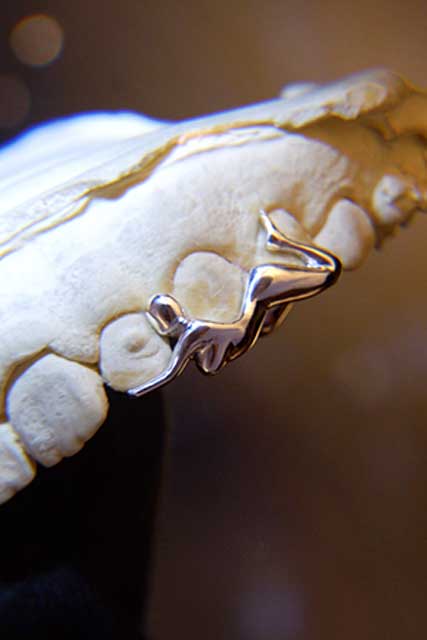 DATUWRKS custom grillz gallery showcase 17