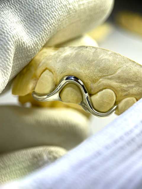 DATUWRKS custom grillz gallery showcase 6