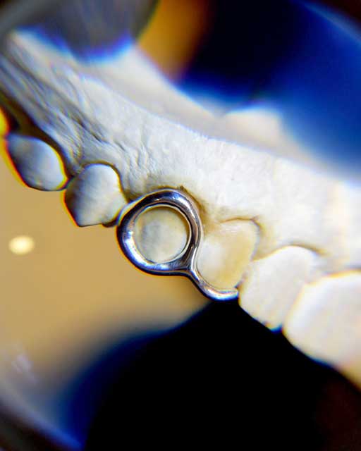 DATUWRKS custom grillz gallery showcase 22