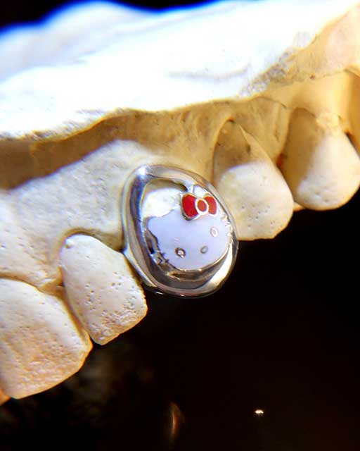 DATUWRKS custom grillz gallery showcase 9