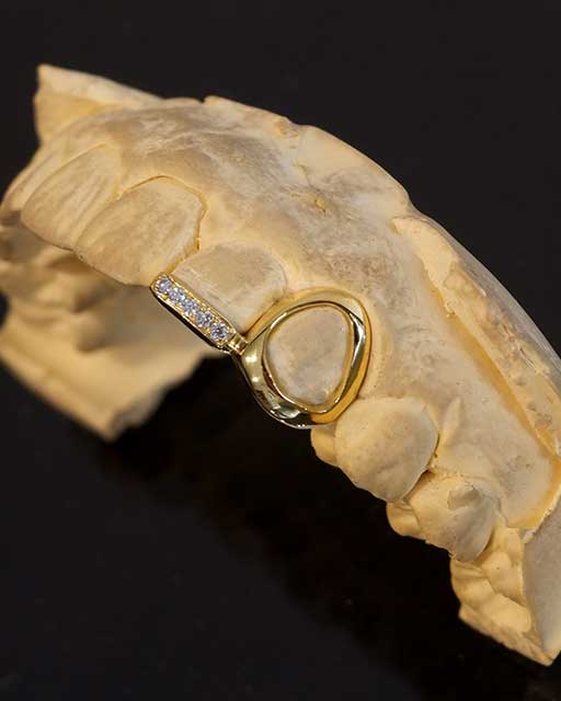 DATUWRKS custom grillz gallery showcase 24