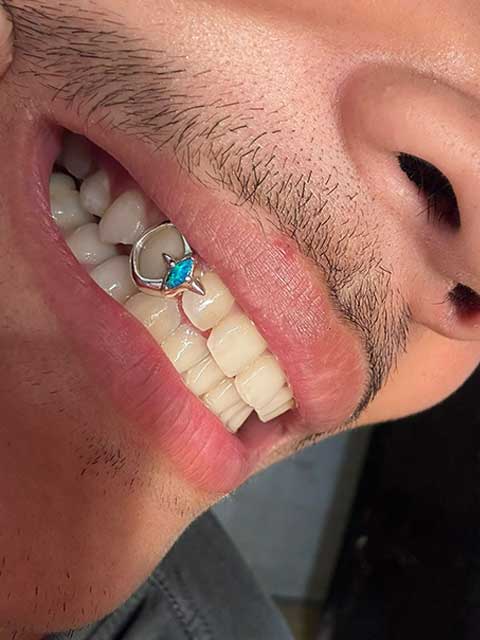 DATUWRKS custom grillz gallery showcase 25
