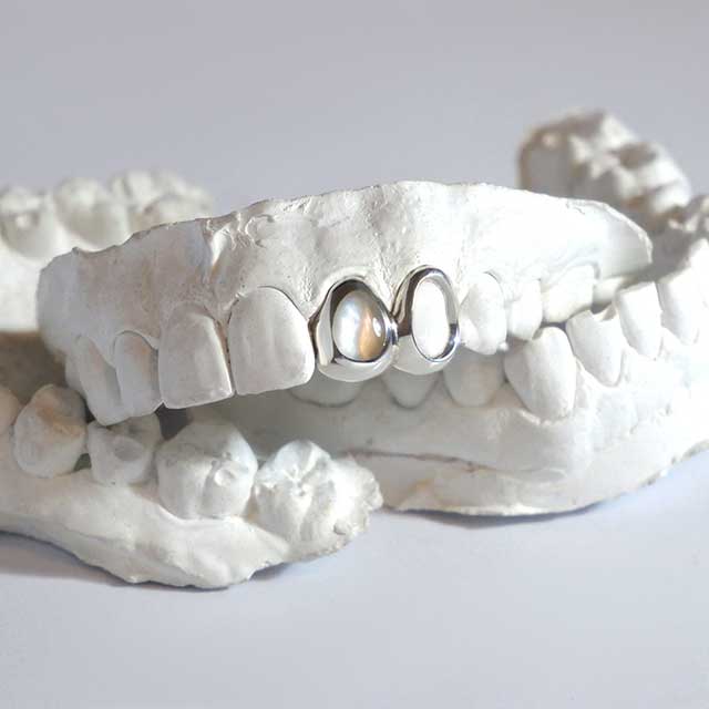 DATUWRKS custom grillz gallery showcase 14