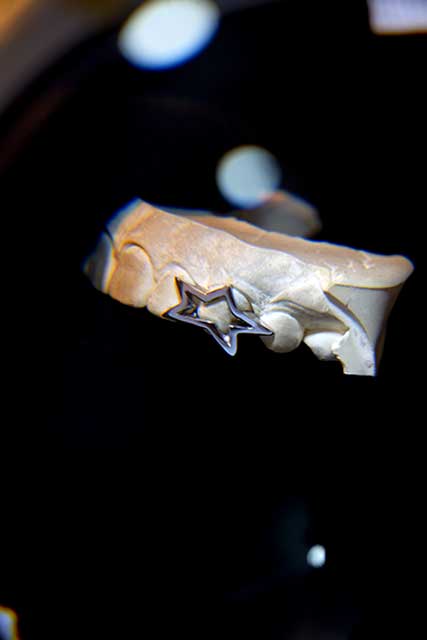 DATUWRKS custom grillz gallery showcase 11